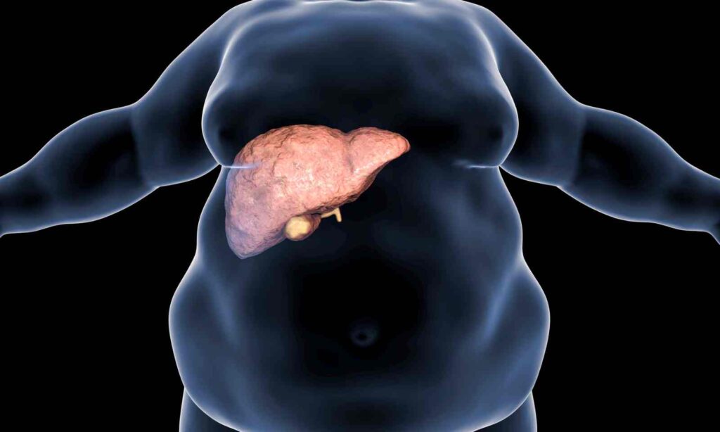Are You At Risk? Surprising Everyday Habits That Might Be Damaging Your Liver!